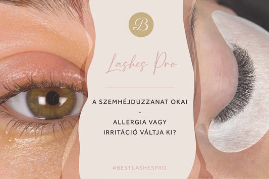 Szemhéjduzzanat: Mi az oka és mit tehetünk ellene? | Best Lashes ®